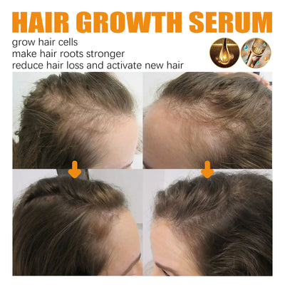 30ml Thick & Strong Hair Essence